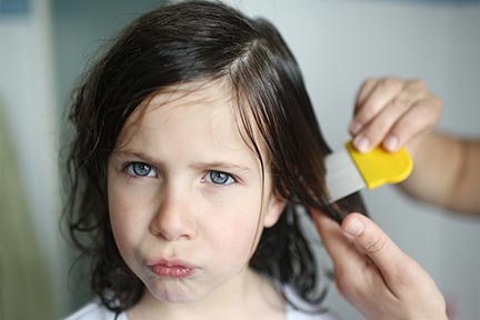 Strategies to Combat Head Lice in Children | Rocky Mountain Hospital for Children Strategies to Combat Head Lice in Children | Rocky Mountain Hospital for Children